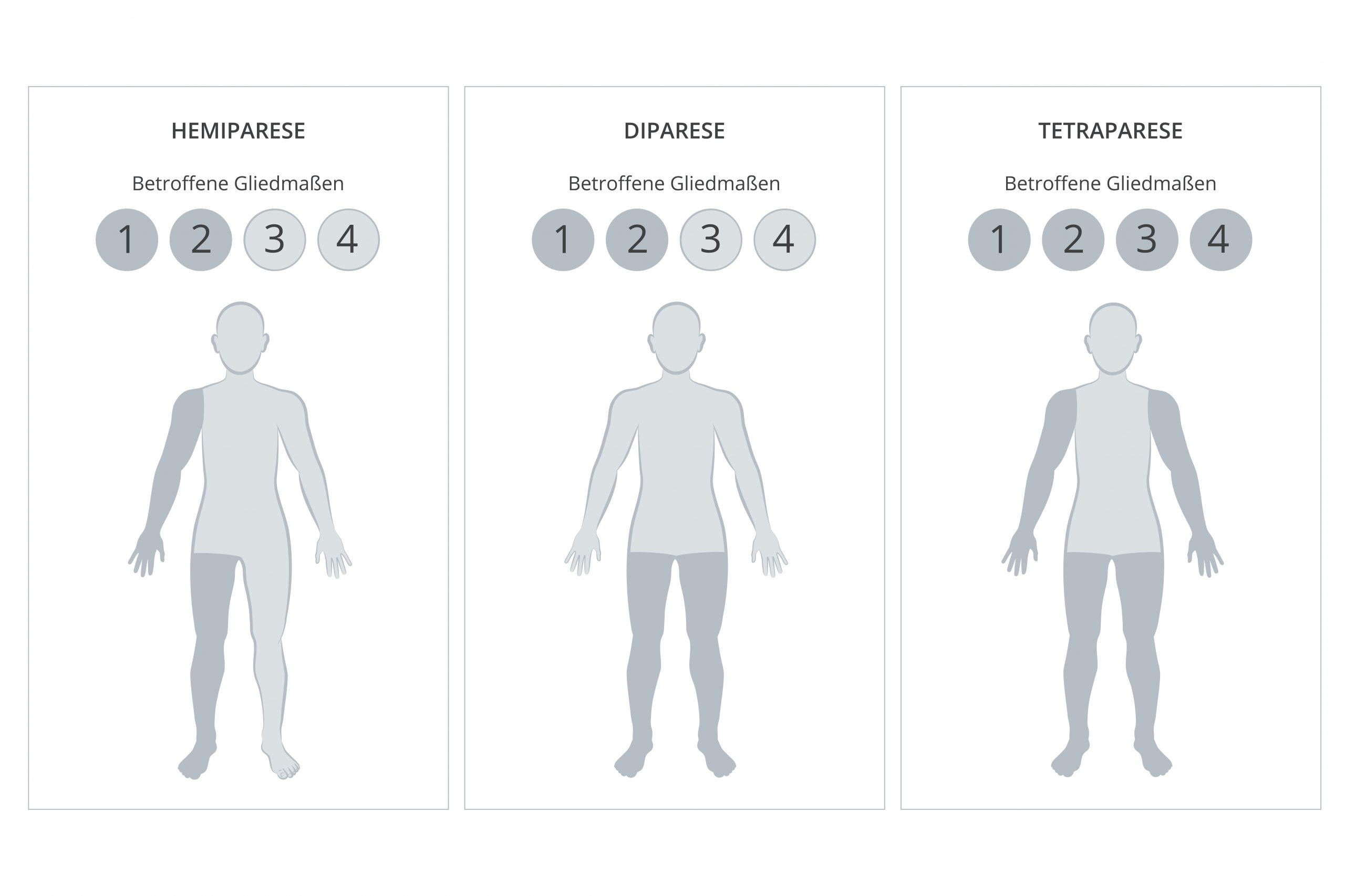 infantile-cerebralparese-betroffene-gliedmasse